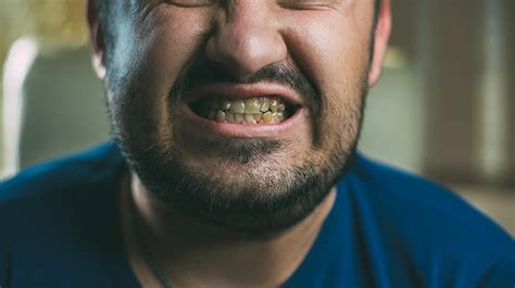 Meth Effects On Teeth Signs Of Meth Addiction Meth Addiction Treatment