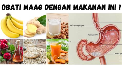 Penyebab Dan Makanan Untuk Mengobati Asam Lambung Dr Ema Surya P