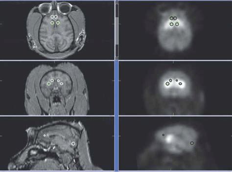 Left Panel Mri From A Monkey Showing Three Planes Horizontal