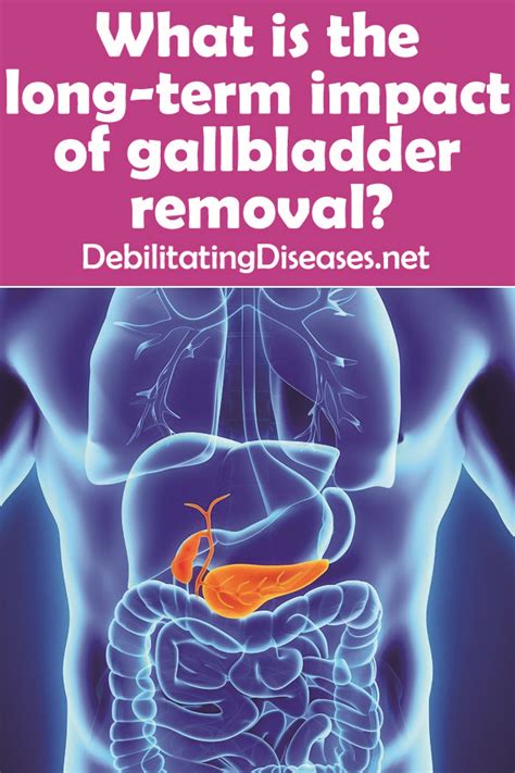 Can Gallbladder Cause Weight Gain Thermovape