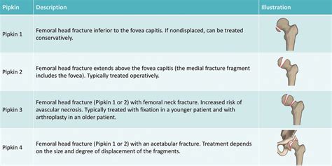Summary Of The Pipkin Classification Of Femoral Head Fractures