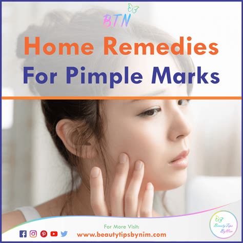 How To Get Rid Of Pimple Marks At Home Remedies Beauty Tips By Nim