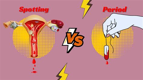 7 Key Difference Between Spotting And Period Spotting Vs Period Youtube