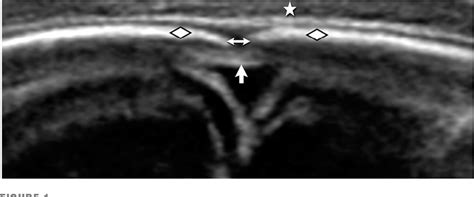 Figure 1 From Cranial Ultrasound As A First Line Imaging Examination