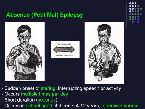 Ppt Pediatric Neurology Review Powerpoint Presentation Free Download