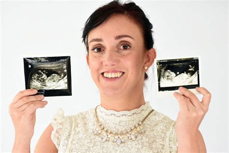 Woman With Two Vaginas Uteruses And Cervixes Has Two Miracle Babies