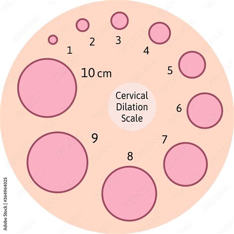 Cervial Dilation Scale With Pink Circles Shows How Cervix Is Opening During Delivery Procwss