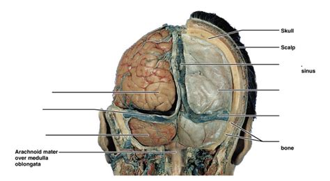 Arterioles connect with even smaller blood vessels called capillaries. ventricles, meninges, CSF and blood vessels of the brain Flashcards | Easy Notecards