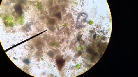 Microscopic Organisms In Pond Water Youtube