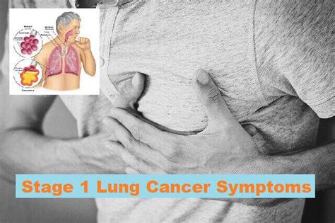Stage Lung Cancer Symptoms You Need To Know
