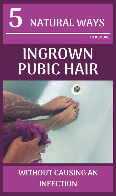 A cyst from ingrown hair can start and grow in areas covered with skin including the scalp, on the face, under armpits, pubic area and groin. Pin on Natural Home Remedy