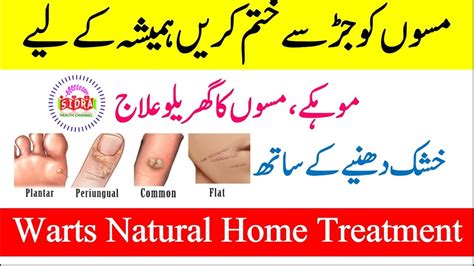 Pregnancy test at home ghar pe hamal test karne ka tarika how to test pregnancy pregnancy symptom. Warts ka treatment in urdu, Meaning of papilloma in ...