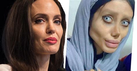 Botched Teen Gets 50 Plastic Surgeries To Look Like Angelina Jolie