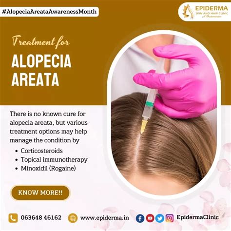 Ppt Treatment For Alopecia Areata Dermatologist In Bangalore