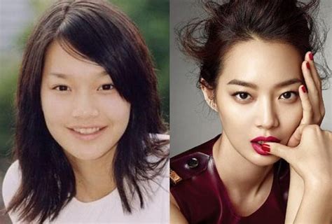 Shin Min Before And After Photos