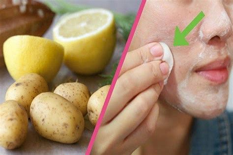 Recipes On How To Use Potatoes To Get Rid Of Your Dark Spots With No