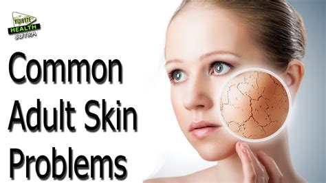 Common Adult Skin Problems Youtube