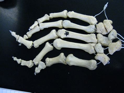 Boned Human Skeleton Hand