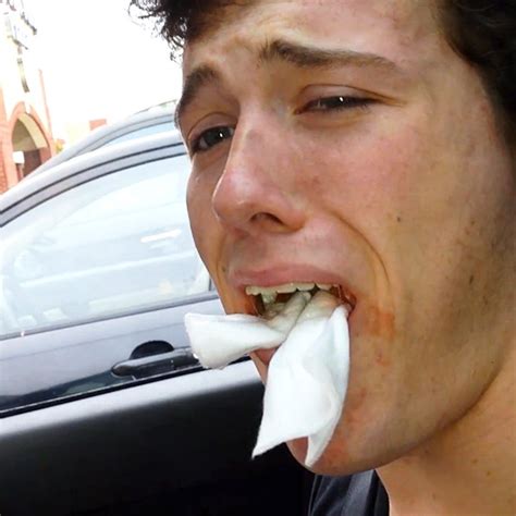 Watch Guy Cries For Beyoncé After Getting Wisdom Teeth Pulled E Online