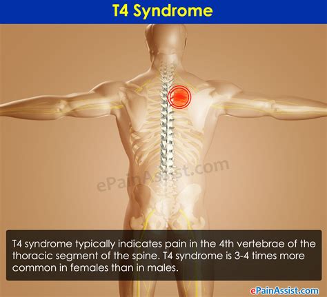 t4 syndrome signs symptoms causes treatment recovery