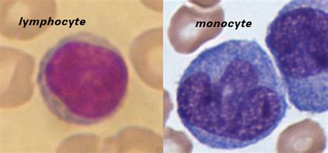 Reactive Lymphocytes And Monocytes Pictures To Pin On
