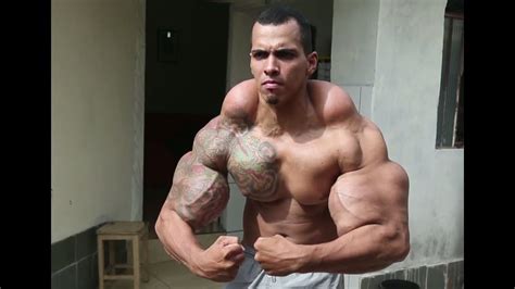 Synthol Freaks Dont Become The Next Synthol Man Hodgetwins Youtube