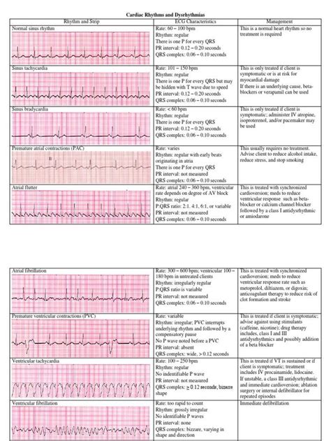 Cardiac Dysrhythmias With Ekg Tracings And Methods Of Treatment All