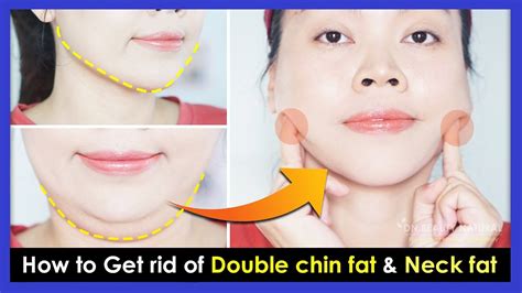 how to get rid of double chin fat and neck fat double chin removal and wrinkles exercises