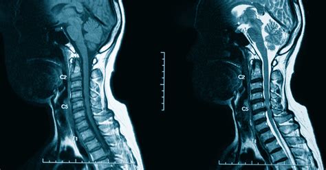 CT With Contrast and MRI With Contrast: Facts to Know • Touchstone