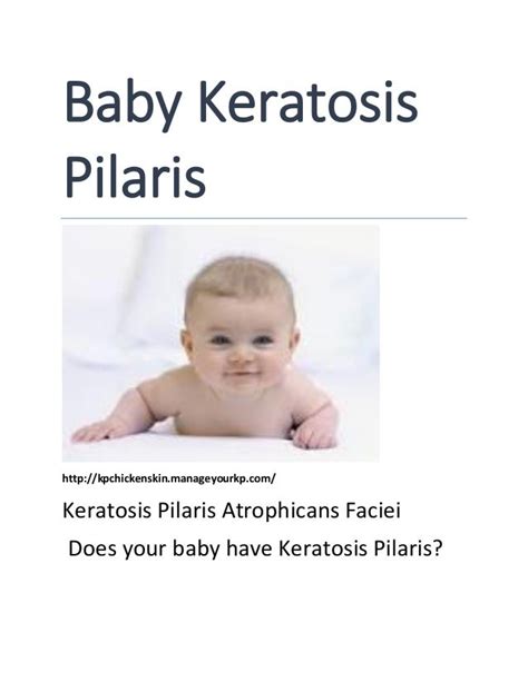 Baby Keratosis Pilaris
