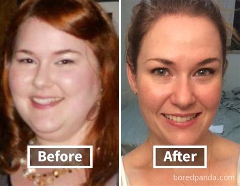 Amazing Before And After Pics Reveal How Weight Loss Affects Your Face