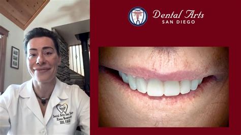 Dental Case Studies Dental Arts San Diego
