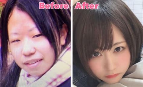 25 year old s japanese girl s plastic surgery transformation stuns internet face of malawi