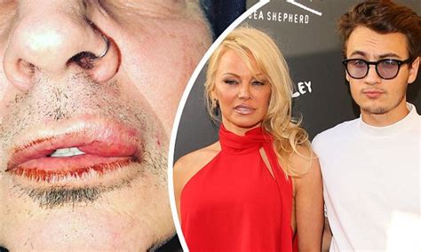 Tommy Lee Lunged At Son Who Was Defending Mom Pamela Anderson