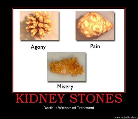 Check out our kidney stone humor selection for the very best in unique or custom, handmade pieces from our shops. kidney stones motifake 47161 demotivational poster ...