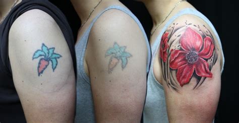 This paper will review the clinical manifestations and the most common compounds. How to treat an infected tattoo and tattoo ink allergy?