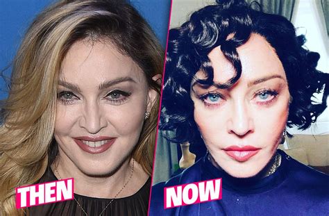 Madonna Before And After Plastic Surgery Face Boobs Buttocks My XXX