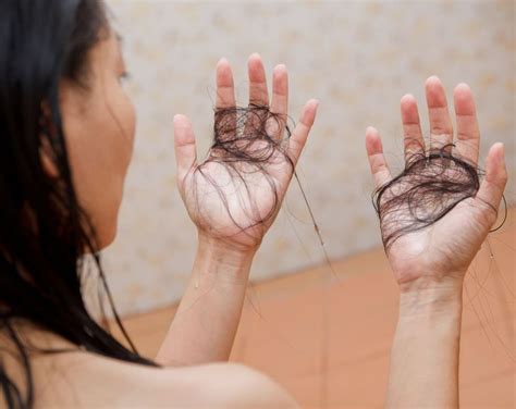 Causes Of Hair Loss And 7 Ways To Tell If Youre Losing Too Much Of It