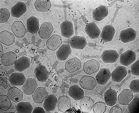 Virus Scanning Electron Microscope Images Micropedia