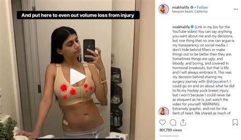 Mia Khalifa Shared A Video From Her Breast Surgery After She Was Hit By An Ice Hockey Puck Last