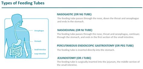 How To Insert Enteral Feeding Tube