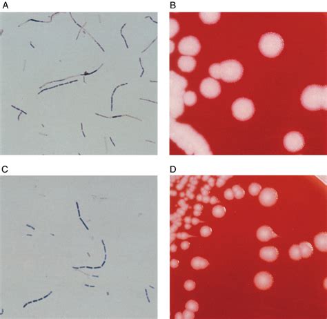 Gram Stains And Colony Morphologies Of Selected B Anthracis Like