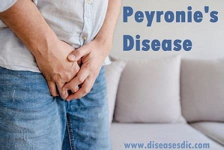 Peyronie S Disease Causes Stages Symptoms And Treatment