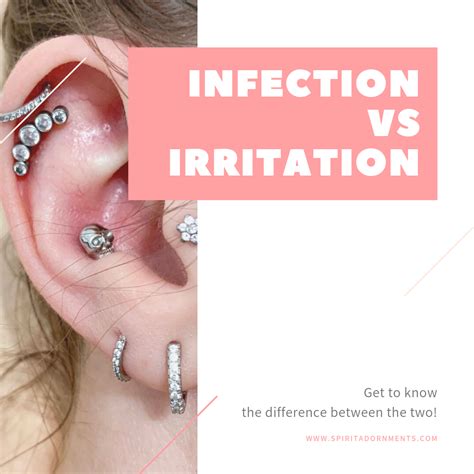 Piercing Infection Vs Common Irritation Spiritadornments