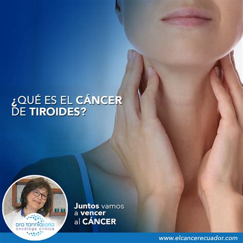¿qué Es El Cáncer De Tiroides Dra Tannia Soria Oncóloga Clínica