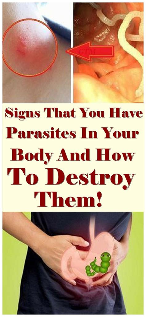 Signs That You Have Parasites In Your Body And How To Destroy Them Digestive Problems Signs