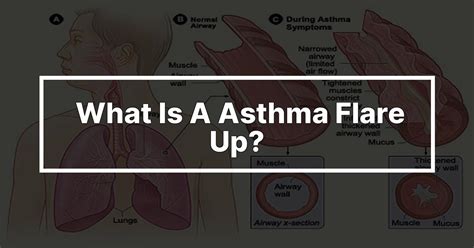 what is a asthma flare up lestgodo