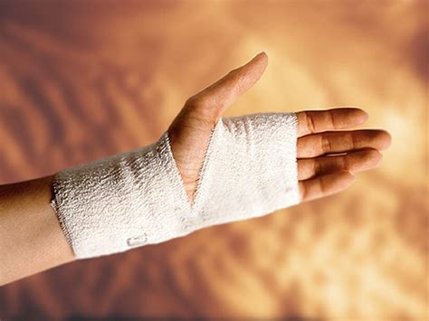 Cast Immobilization Recommended For Scaphoid Fractures Consumer