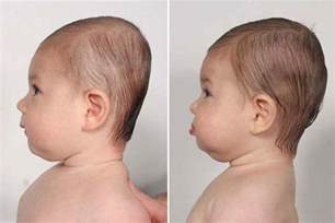 Da Baby Head Shape The Ins And Outs Of Flat Head Syndrome In Babies