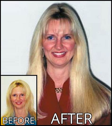 Before After Archives The Best Hair Extension Institute In Atlanta